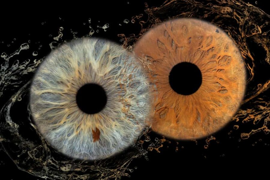 IRIS Photography (macro photo of your eye) - What happens at Kralja Zvonimira 7